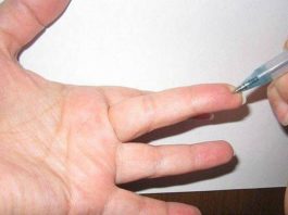 Особая точка на пальце, которую используют в военной медицине