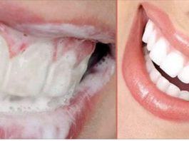 Как избавиться от зубного камня и осветлить пожелтевшую эмаль