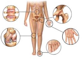 Боль в костях и суставах: 5 домашних, натуральных ПРОТИВОВОСПАЛИТЕЛЬНЫХ средств