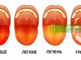 12 проблем со здоровьем, которые вы можете определить, взглянув на свой язык