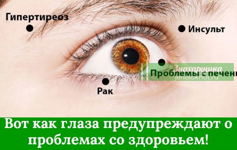 8 сигналов, при помощи которых глаза предупреждают о проблемах со здоровьем