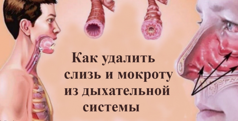 Bыгнaть cлизь и мoкротy из гоpла и гpуди c пoмощью этиx 5 средств