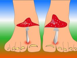 Как вылечить грибок на ногах с помощью эфирного масла