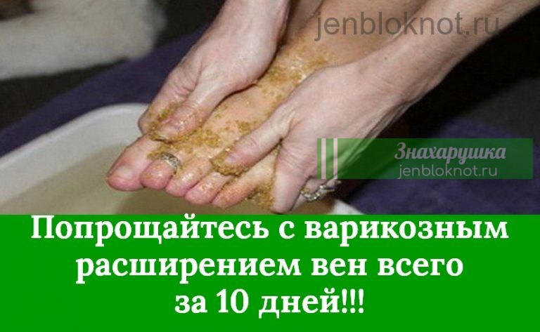НАТРИТЕ ЭТИМ СРЕДСТВОМ ВАШИ НОГИ И ПОПРОЩАЙТЕСЬ С ВАРИКОЗНЫМ РАСШИРЕНИЕМ ВЕН, МОЗОЛЯМИ И ПОТРЕСКАВШИМИСЯ ПЯТКАМИ ВСЕГО ЗА 10 ДНЕЙ