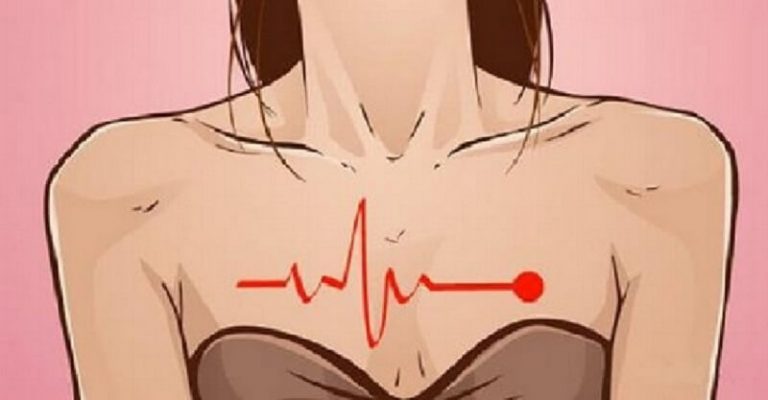 Интересный факт: инфаркт у женщин проявляется по-другому. 5 странных и неожиданных симптомов, которые нельзя игнорировать