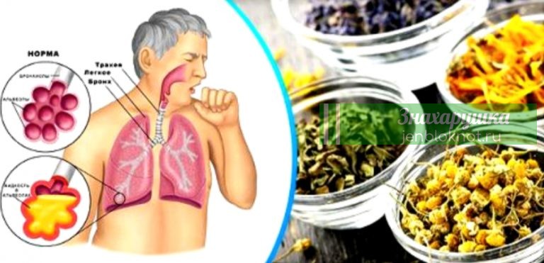 Отхаркивающие травы для очищения легких и выведения мокроты