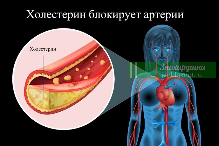 Держи сосуды в чистоте и тонусе: 5 золотых рецептов от травника