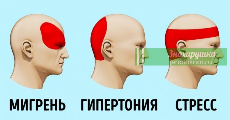 ВОТ, КАК ОСТАНОВИТЬ ГОЛОВНЫЕ БОЛИ ЗА 5 МИНУТ БЕЗ ЛЕКАРСТВ