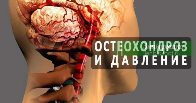 Неразлучная парочка. Шейный остеохондроз и высокое давление