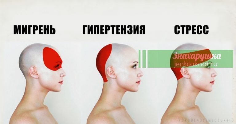 ВОТ, КАК БЫСТРО ОСТАНОВИТЬ ГОЛОВНЫЕ БОЛИ ЗА 5 МИНУТ БЕЗ ЛЕКАРСТВ
