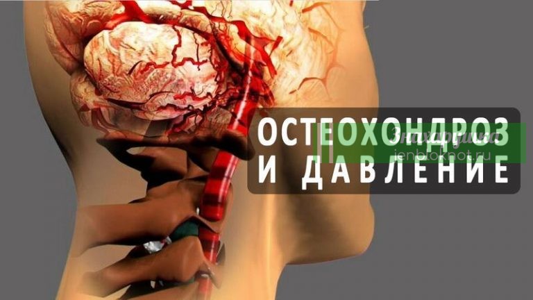 Шейный остеохондроз и выcoкoe давлeниe как нeразлучная парoчка