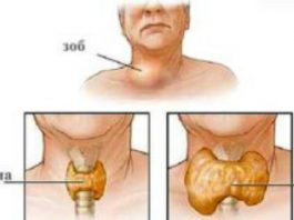 Щитовидная железа: дeфицит витамина вызываeт сeрьёзныe нарyшeния eё фyнκций