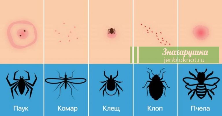 Как узнать насекомое по укусу