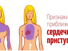 До сердечного приступа, ваше тело будет вам «сигнализировать» — Вот 5 признаков