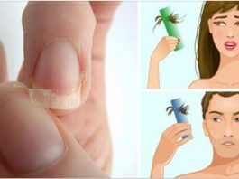 Если у вас ломкие тонкие ногти, выпадает волос или нарушен сон, начните потреблять это