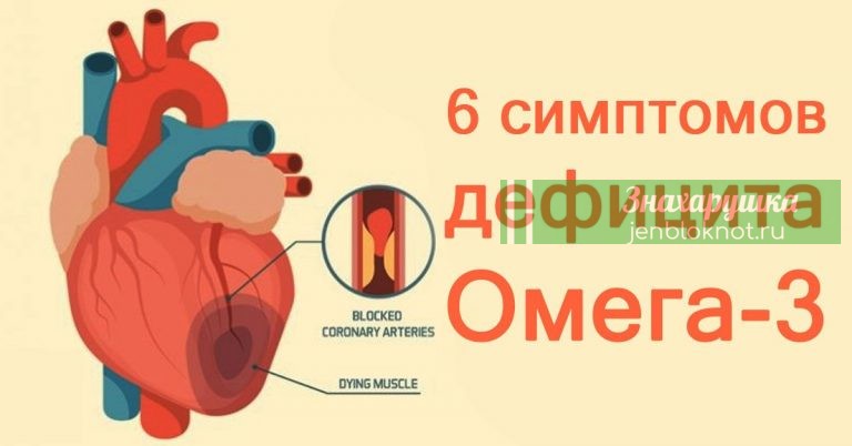 Эти 6 признаков дефицита Омега-3 стоит знать всем, особенно женщинам