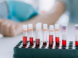 Расшифровка – общий анализ крови