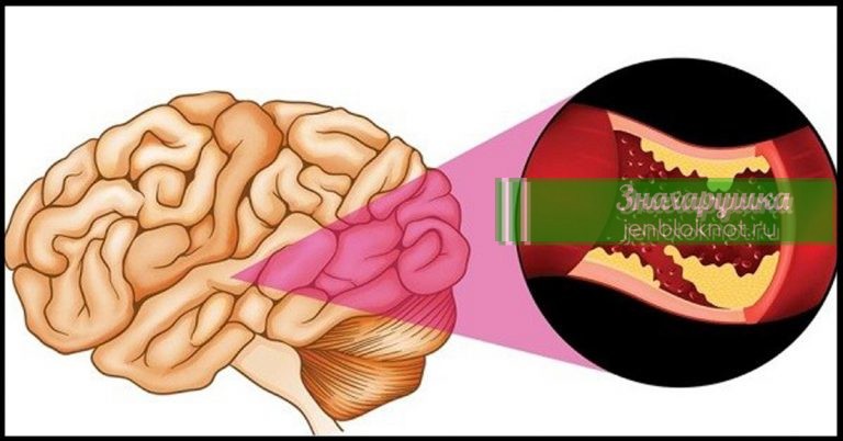 Эта информация может спасти вашу жизнь. Стоит знать каждому