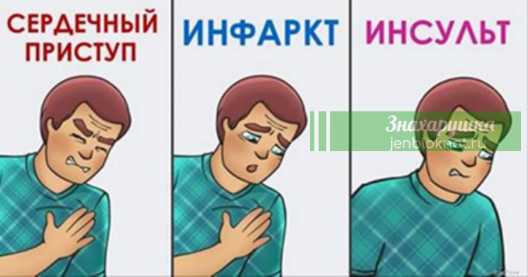 Как различить сердечный приступ, инфаркт и инсульт