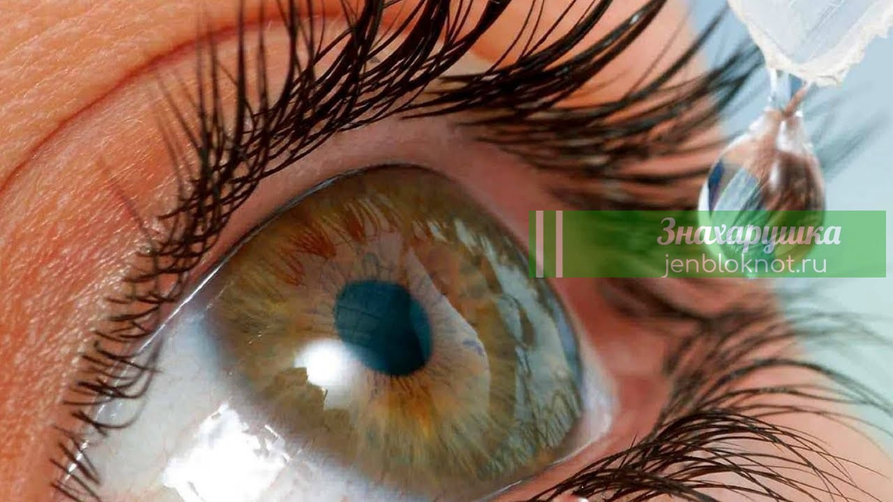 Лечение катаракты народными средствами без операции ᐈ Народные методы и  средства при катаракте глаз | avatar-medical