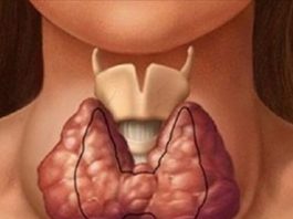 Щитовидная железа — это та, которая контролирует все тело. Вот как сохранить ее здоровье