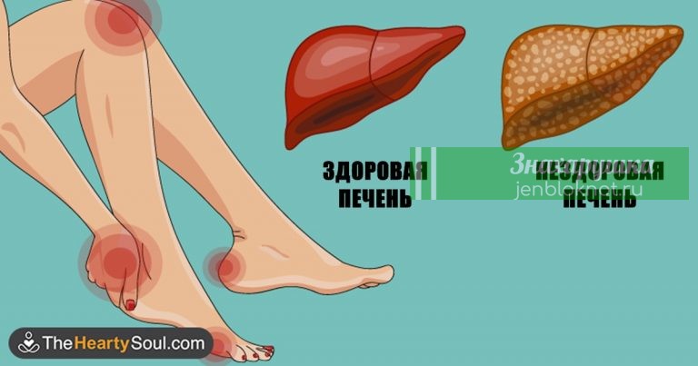 Вот как тело предупреждает вас, что ваша печень в опасности