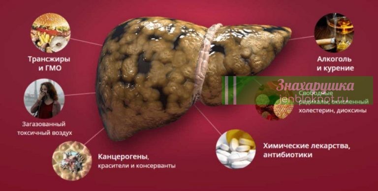 Как разгрузить печень. Вы можете болеть и не знать причины