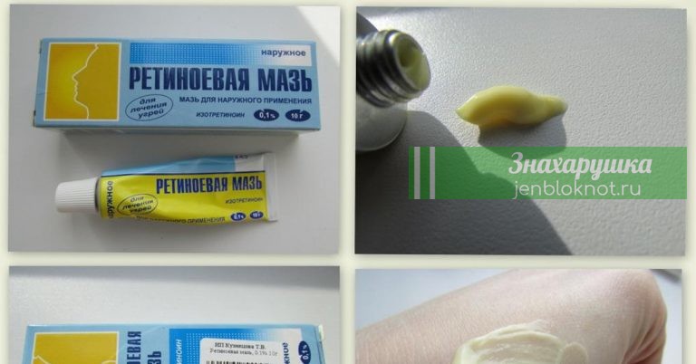 Копеечные средства для красоты из аптеки. Обычная косметика в долю не падает