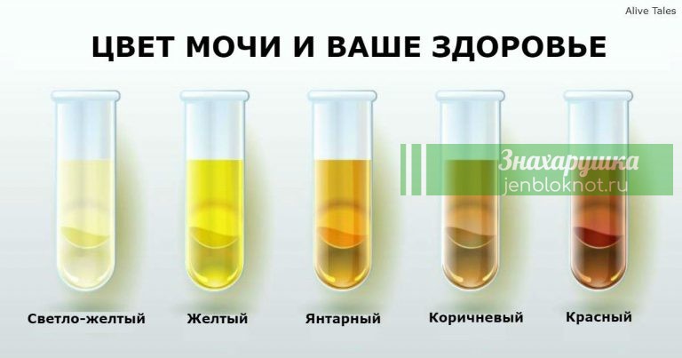 Вот что может рассказать о вашем здоровье цвет и запах вашей мочи