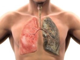 Что происходит с вашим телом, когда вы бросаете курить