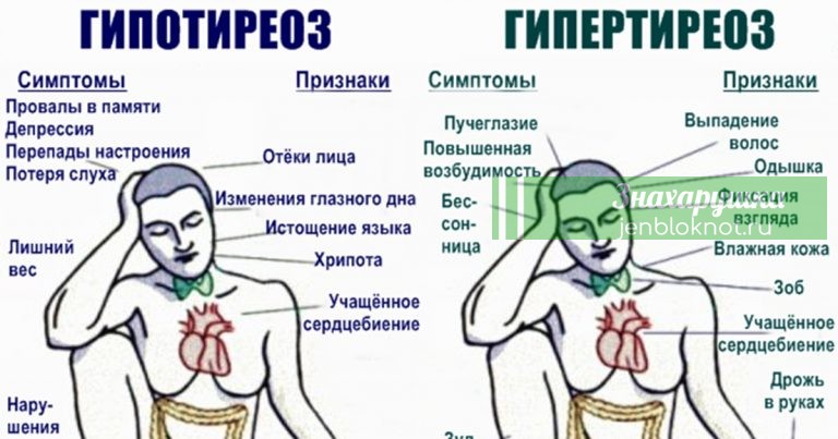 93% людей с проблемами со щитовидкой не знают об этом. Вот вся нужная информация