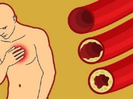9 продуктов, которые естественным способом очищают артерии