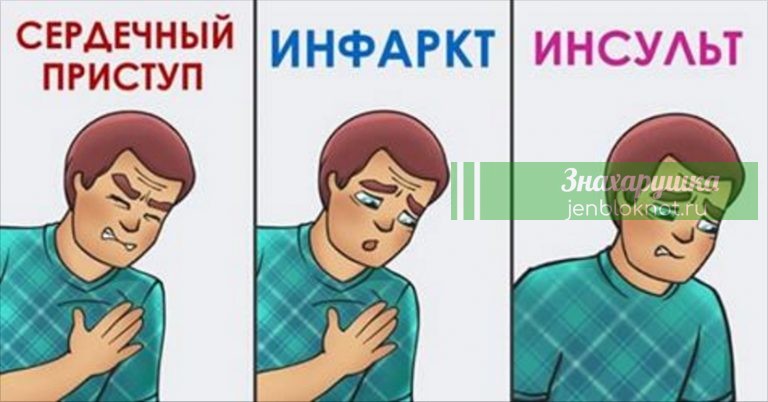 Как различить сердечный приступ, инфаркт и инсульт