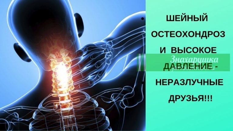 Шейный остеохондроз и высокое давление как неразлучная парочка