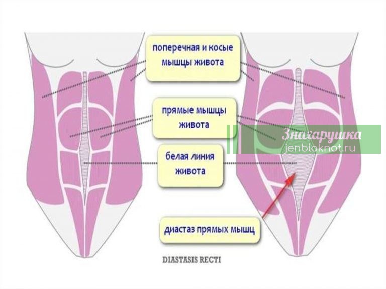Из-за диостаза вы не сможете похудеть. Все что нужно в этой статье