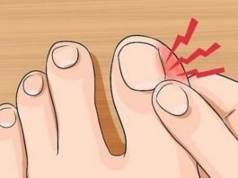 Как избавиться от грибка ногтей быстро и навсегда