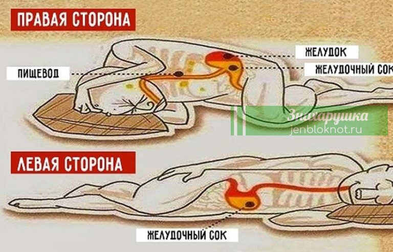 Помните: Всегда спите на левом боку. Вот почему