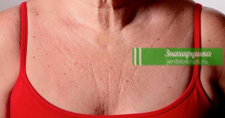 Три специальных рецепта быстро устранят морщины на груди и шее — вы будете чувствовать себя намного моложе
