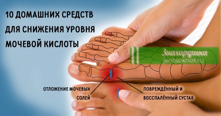 ИЗБАВЬСЯ от мочевой кислоты и вылечи подагру. 10 натуральных средств