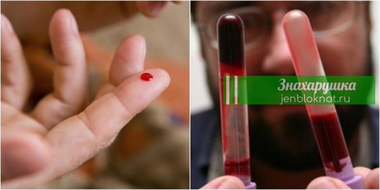 Кардиолог: «7 продуктов разжижают густую кровь, обязательно включите их в рацион»