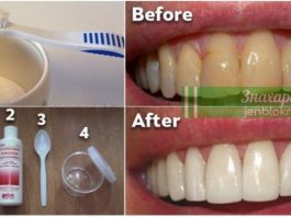 Как избавиться от зубного налета и отбеливать зубы без дорогостоящих процедур. Вам понравится это средство