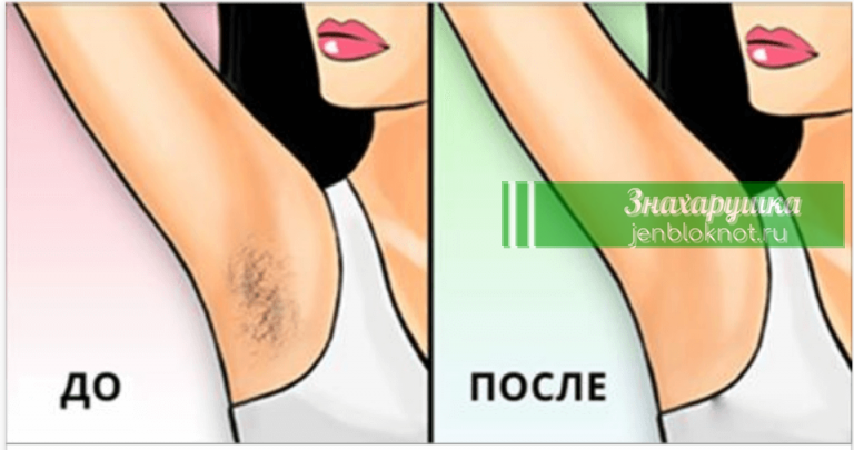 Вот 3 способа НЕ брить подмышки, но сделать их гладкими как фарфор