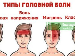 Есть 4 вида головной боли. Вот как правильно избавиться от каждой из них