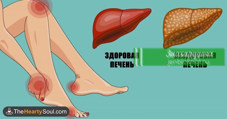 Вот как тело предупреждает вас, что ваша печень в опасности