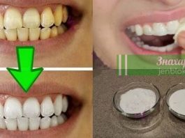 Отбеливание желтых зубов менее чем за 2 минуты