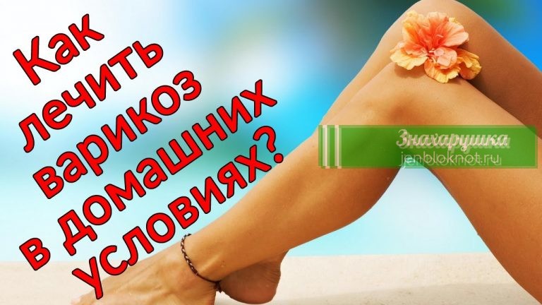 11 домашних средств против варикоза