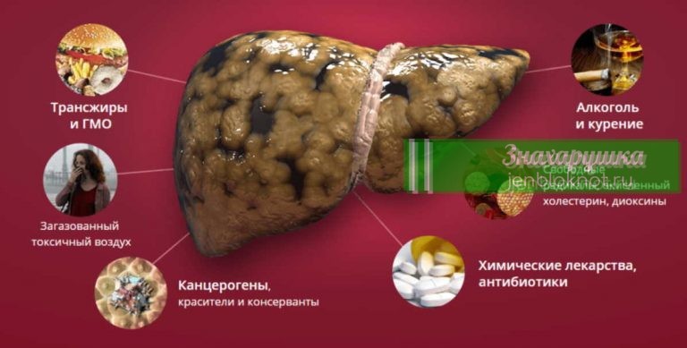 Как разгрузить печень. Вы можете болеть и не знать причины