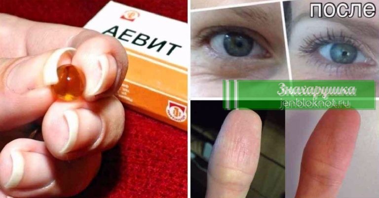 Лекарство «Аевит» творит чудеса. Действенное средство за копейки…