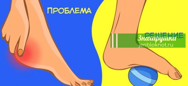 Простые упражнения, которые помогут вам избавиться от болей в области тазобедренного сустава, колена или стопы