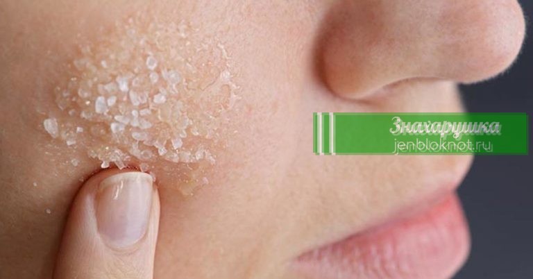 Сульфат магния: избавит от выпадения волос, прыщей, болей в суставах, запоров и не только
